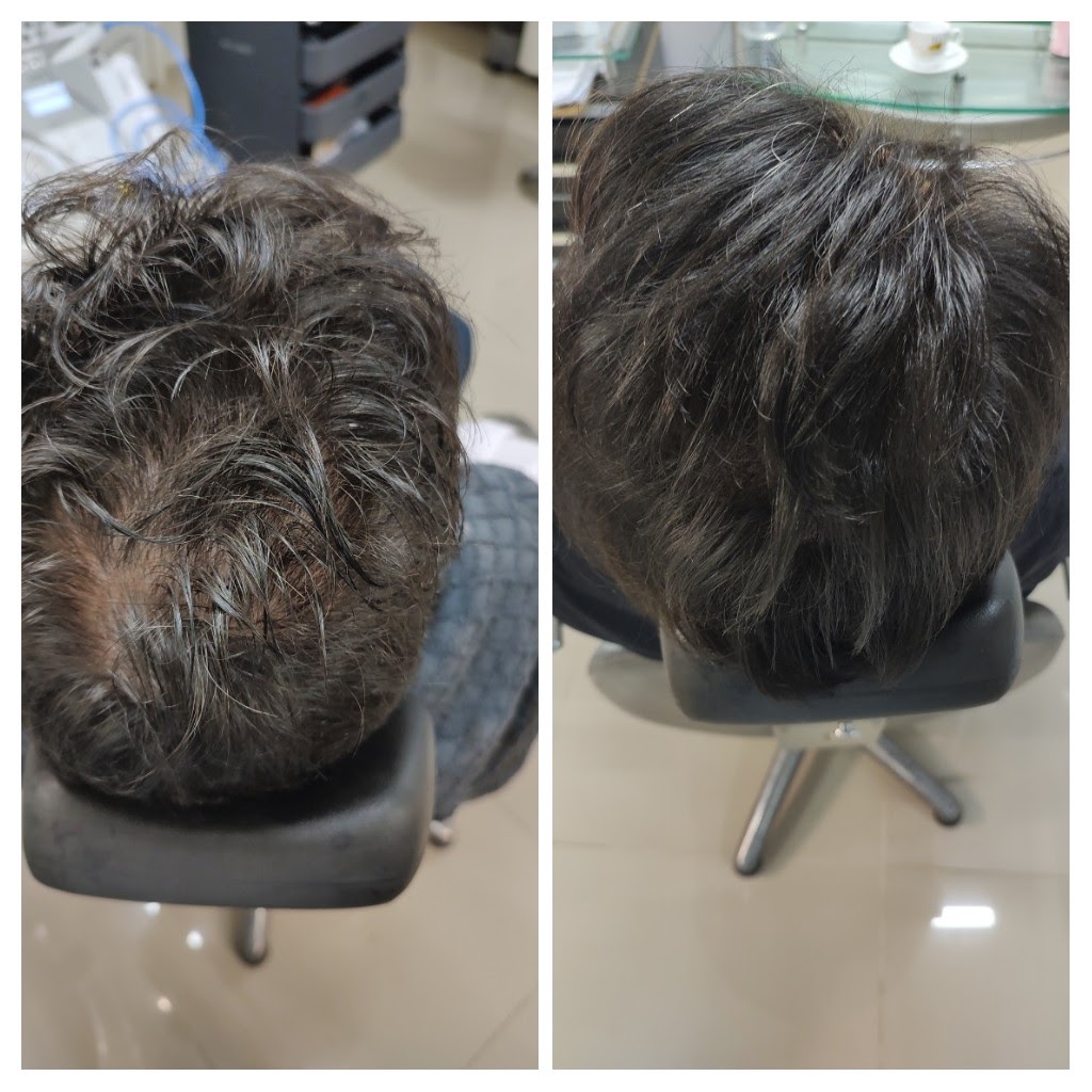 20220720_183630-COLLAGE