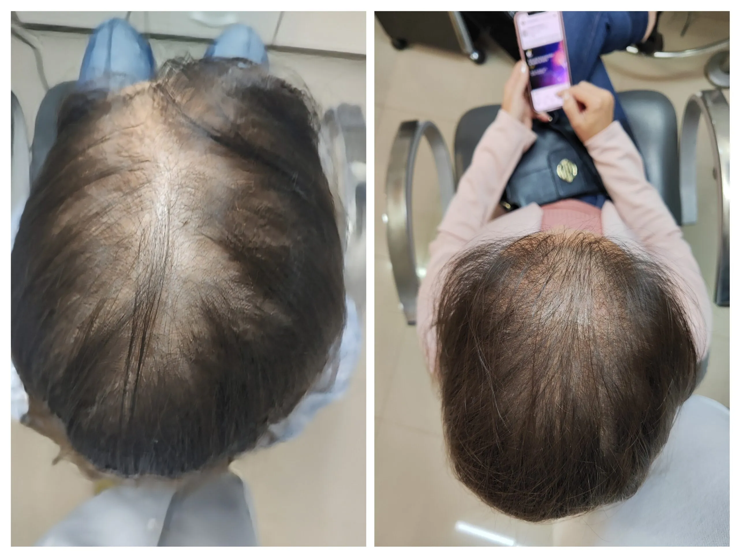 20230721_183818-COLLAGE