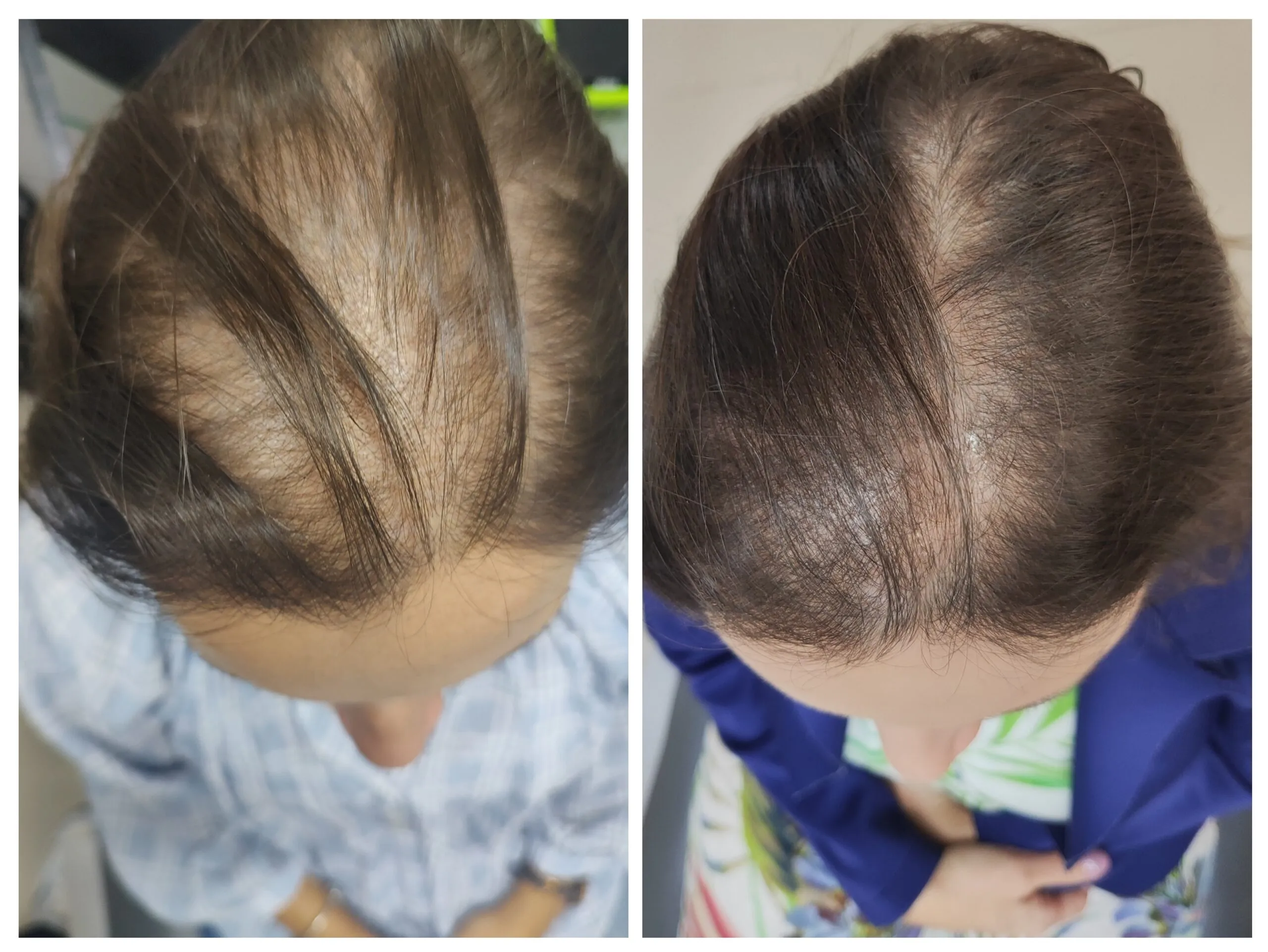 20230812_111623-COLLAGE