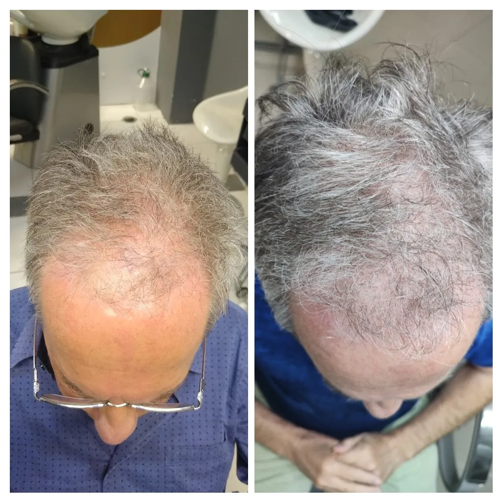 20220827_151518-COLLAGE